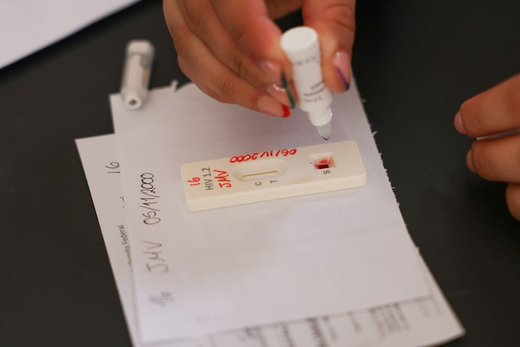 Ação no DF oferece testagem rápida e informação sobre HIV/Aids