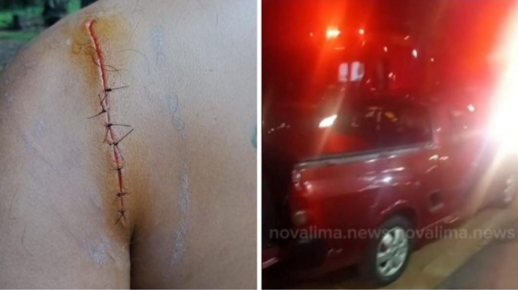 Rapaz recebe 7 pontos após ser esfaqueado por engano no Colúmbia